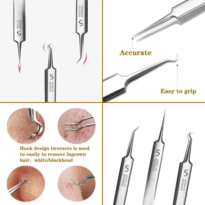 ✨ Precision Blackhead Tweezer Set – 3 Stainless Steel Tip Styles