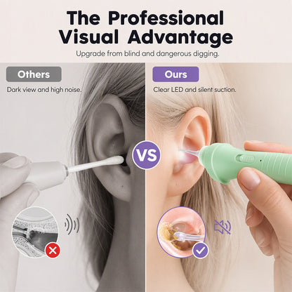 👂 LED Ear Wax Removal Tool – 65kPa Suction Ear Cleaner with Light, Soft Silicone Tips & Rechargeable Home Ear Care Kit